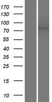 TMEM16K (ANO10) Human Over-expression Lysates NM_018075