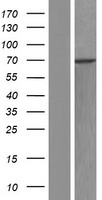 RBM28 Human Over-expression Lysates NM_001166135