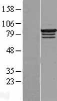 RBM28 Human Over-expression Lysates NM_018077