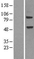 ELP3 Human Over-expression Lysates NM_018091