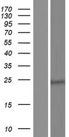 CEP27 (HAUS2) Human Over-expression Lysates NM_001130447