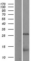 CDCA8 Human Over-expression Lysates NM_018101