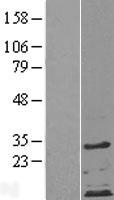 ZDHHC4 Human Over-expression Lysates NM_018106
