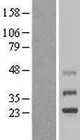 TMEM38B Human Over-expression Lysates NM_018112