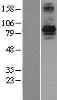 RFWD3 Human Over-expression Lysates NM_018124