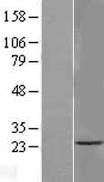 ls055161 tmem33 human over expression lysates nm 018126 wb testing 1