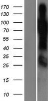 ls055164 shq1 human over expression lysates nm 018130 wb testing 1