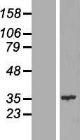 CENPQ Human Over-expression Lysates NM_018132