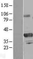 PRMT6 Human Over-expression Lysates NM_018137