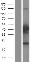 PRMT6 Human Over-expression Lysates NM_018137