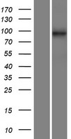 C14orf104 (DNAAF2) Human Over-expression Lysates NM_018139