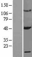 MRPS10 Human Over-expression Lysates NM_018141