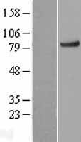 KLHL11 Human Over-expression Lysates NM_018143