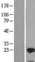 FAIM1 (FAIM) Human Over-expression Lysates NM_001033032