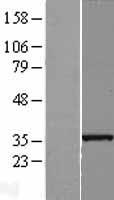 ls055186 slc25a36 human over expression lysates nm 018155 wb testing 1