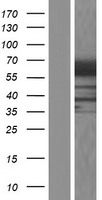 RIC8 (RIC8B) Human Over-expression Lysates NM_018157