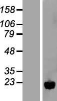 ls055190 nudt11 human over expression lysates nm 018159 wb testing 1