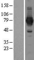 ls055191 nad synthetase nadsyn1 human over expression lysates nm 018161 wb testing 1