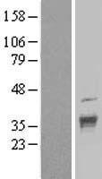 DNAJC17 Human Over-expression Lysates NM_018163