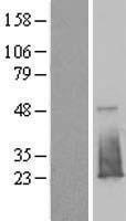 ls055194 fam176b eva1b human over expression lysates nm 018166 wb testing 1