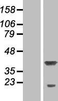ls055197 p15rs rprd1a human over expression lysates nm 018170 wb testing 1