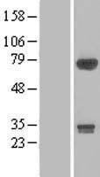 DIP13B (APPL2) Human Over-expression Lysates NM_018171