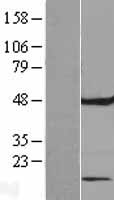 FAM86C1P Human Over-expression Lysates NM_152563