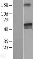 LGI2 Human Over-expression Lysates NM_018176