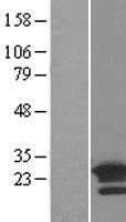 ls055207 arl8b human over expression lysates nm 018184 wb testing 1