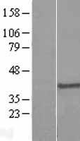 DPPA4 Human Over-expression Lysates NM_018189