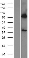 BBS7 Human Over-expression Lysates NM_018190