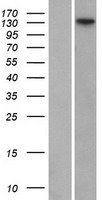 FANCI Human Over-expression Lysates NM_018193