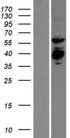 EXD2 Human Over-expression Lysates NM_018199
