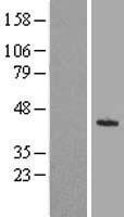 KLHDC8A Human Over-expression Lysates NM_018203