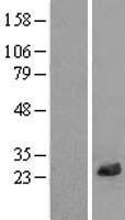 ls055222 lrrc20 human over expression lysates nm 207119 wb testing 1