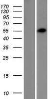 TRIM62 Human Over-expression Lysates NM_018207