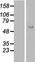 Lano (LRRC1) Human Over-expression Lysates NM_018214