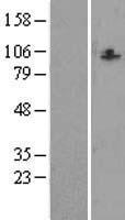 CCDC87 Human Over-expression Lysates NM_018219