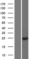 MOBK1B (MOB1A) Human Over-expression Lysates NM_018221