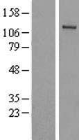UBA6 Human Over-expression Lysates NM_018227