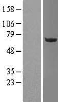 OGFOD1 Human Over-expression Lysates NM_018233