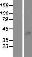 STEAP3 Human Over-expression Lysates NM_018234