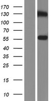 STEAP3 Human Over-expression Lysates NM_182915