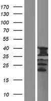 ls055245 uqcc uqcc1 human over expression lysates nm 001184977 wb testing 3