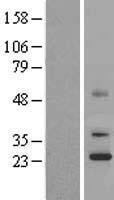 ls055245 uqcc uqcc1 human over expression lysates nm 018244 wb testing 1