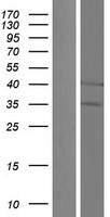 ls055245 uqcc uqcc1 human over expression lysates nm 199487 wb testing 2