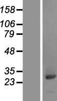 CCDC25 Human Over-expression Lysates NM_018246