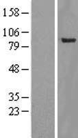YY1AP1 Human Over-expression Lysates NM_139119