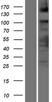 ASXL2 Human Over-expression Lysates NM_018263