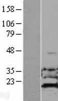ADI1 Human Over-expression Lysates NM_018269